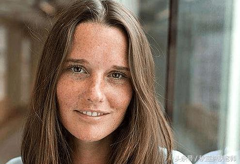 褐斑祛斑,褐斑祛斑最有效方法