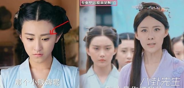 娱乐圈里整容过的演员,娱乐圈整容失败女星