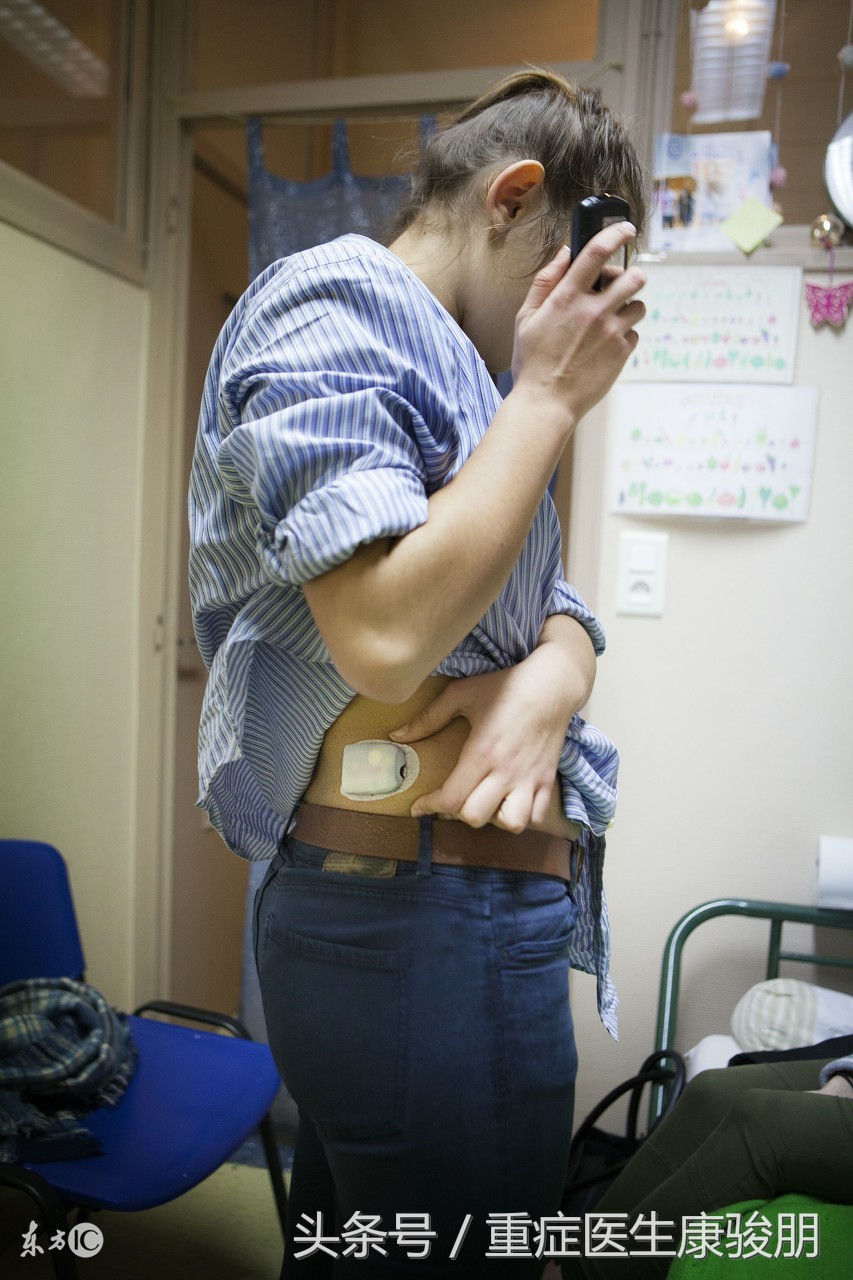 女性糖尿病的10个征兆,女性糖尿病的12个征兆