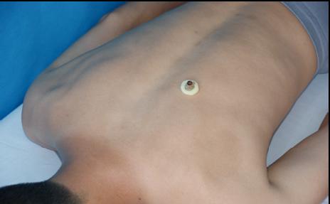 满满干货｜小小艾灸能量大，赶走酒瘾全靠它！