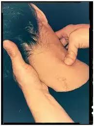 足底肌筋膜放松手法,肌筋膜全套讲解视频