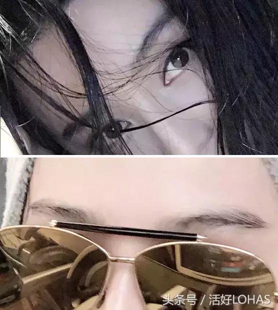 拯救发际线的生发神器,拯救发际线神器