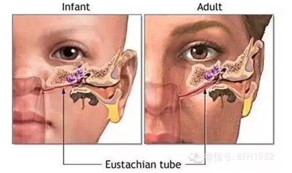 小孩肺炎眼睛发炎有眼屎,儿童肺炎耳朵疼眼睛肿