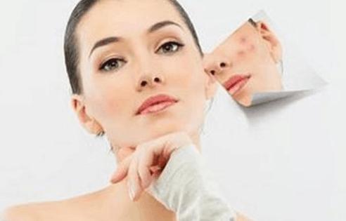 一张脸别被痘印毁了，怎么预防痘印，痘印怎么消除