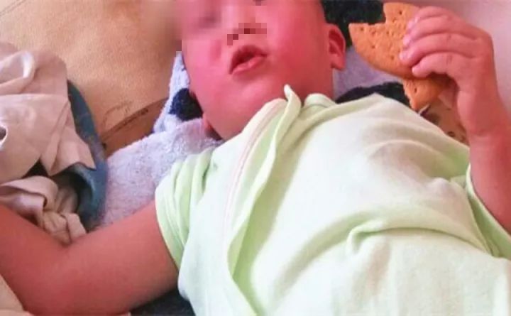 小柴胡怎么是处方药,小柴胡用量用法