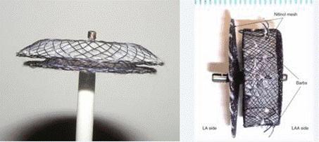 程云阁：患儿房缺1.6mm几岁可以手术？什么情况下可以自愈？