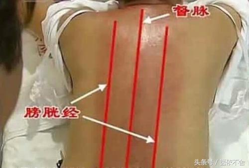 膀胱经治疗穴位,膀胱所有的病变