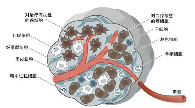 癌症为什么难攻克,癌症治疗为什么困难重重