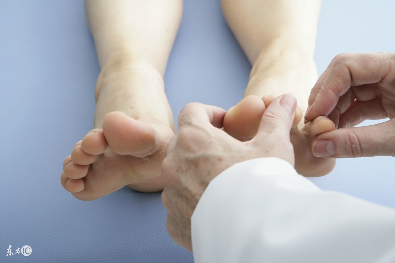 脚跟腱炎怎么治疗最好,鹅脚炎怎么治疗