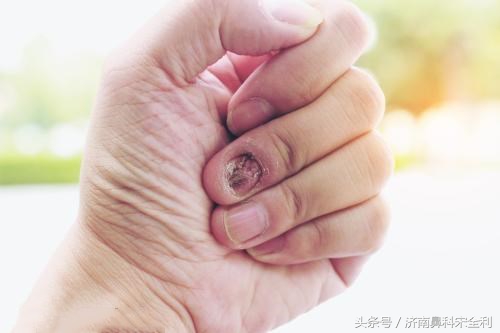 三甲医院通用的《疾病先兆自查表》，我用了几十年，现在还在用！