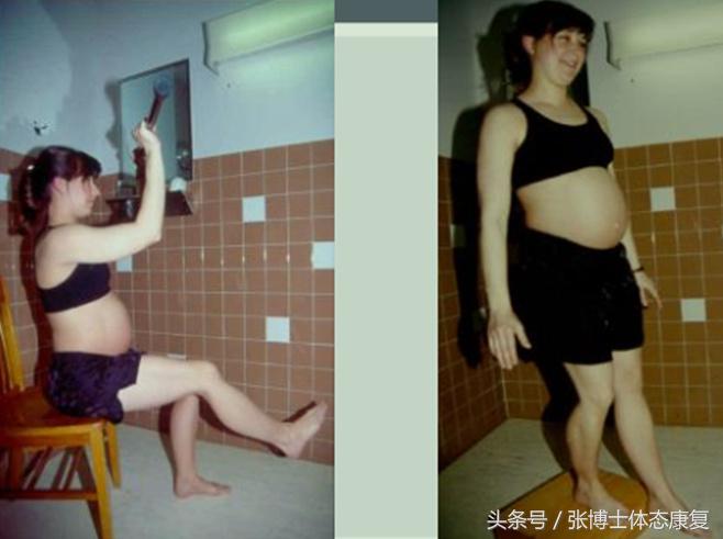 孕期怎么锻炼缓解耻骨疼痛,孕期耻骨疼怎么走路正确