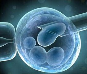 日本干细胞治疗多系统萎缩,日本干细胞能治好脑萎缩吗