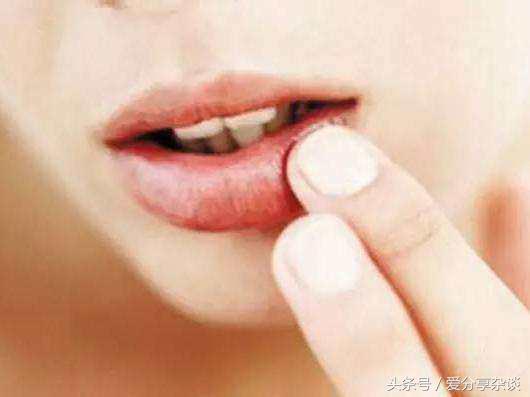 嘴巴起泡了怎么办快速消除,嘴巴起泡最快的解决方法