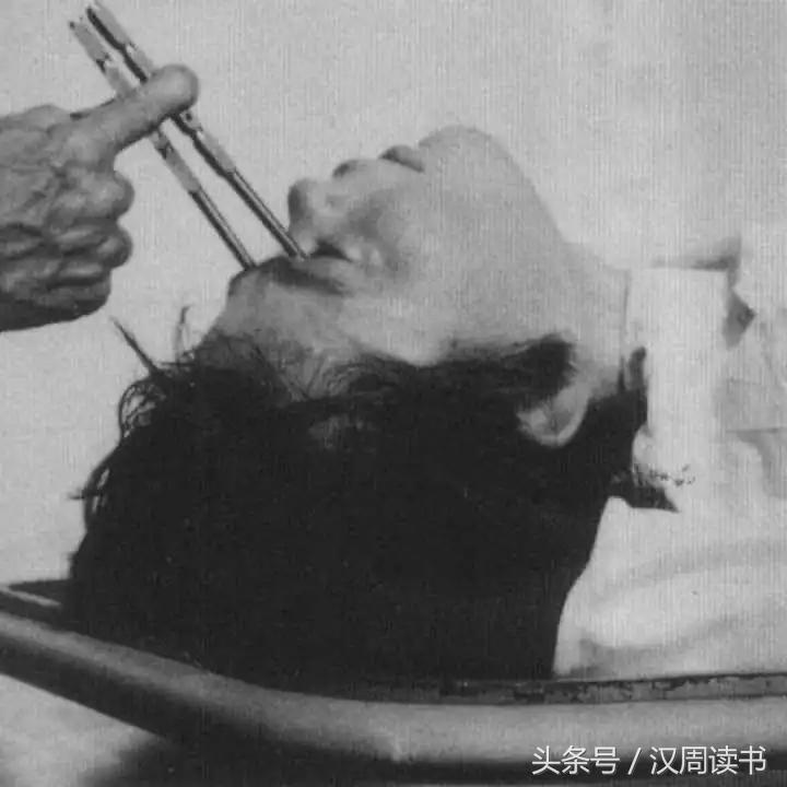 他用一根长钉从眼眶锤入那个人的头颅竟只为了治精神病