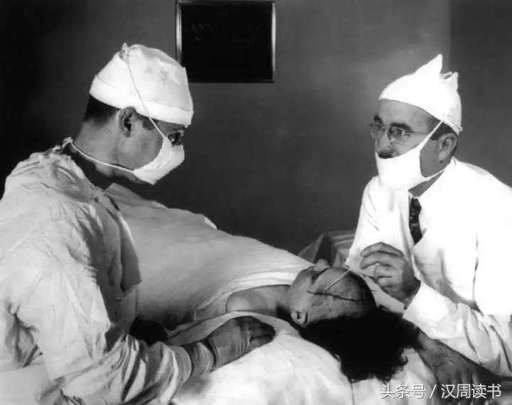 他用一根长钉从眼眶锤入那个人的头颅竟只为了治精神病