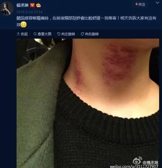 让众多明星痴迷的神秘东方医术!快来get明星同款!