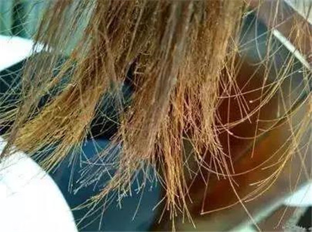 冬天上火怎么办?这些干货教您灭火