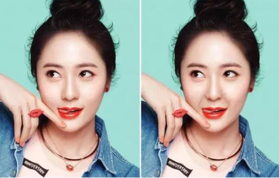 预防法令纹的最好方法,有了法令纹怎么办消除法令纹