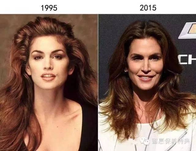 欧美阿姨PK日本大妈——差了10斤胶原蛋白！