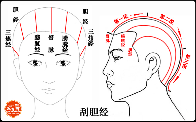 偏头痛刮痧眼睛有点肿了,眼睛干涩刮痧刮哪里