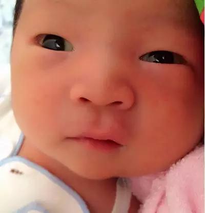 眼白出现这几种颜色，你该警惕了