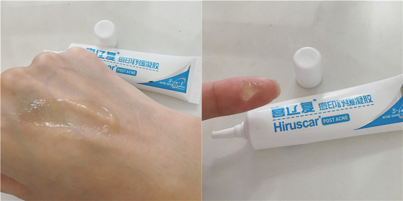 轻松修复痘印告别痘痘肌,有效快速祛痘印