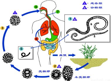 孩子拉出一条虫怎么办,儿童拉屎有虫是什么虫