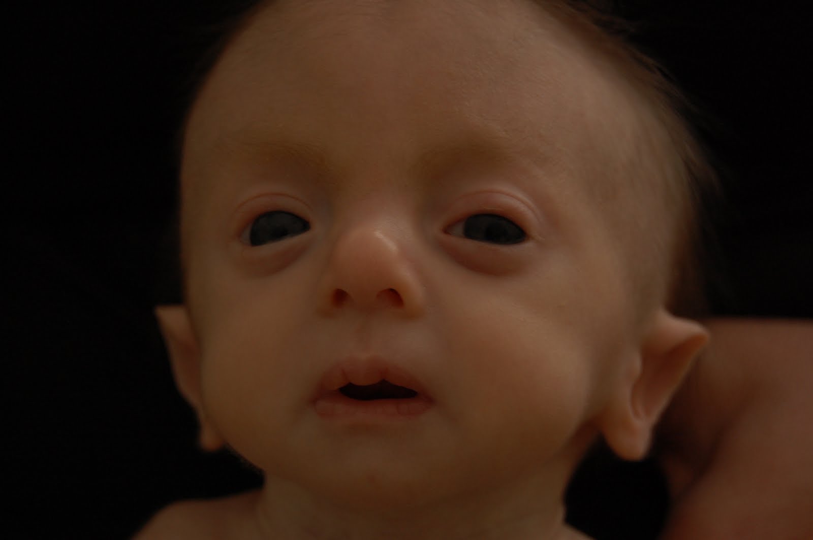 保胎保得好的医生,保胎在医院打针对胎儿有影响吗