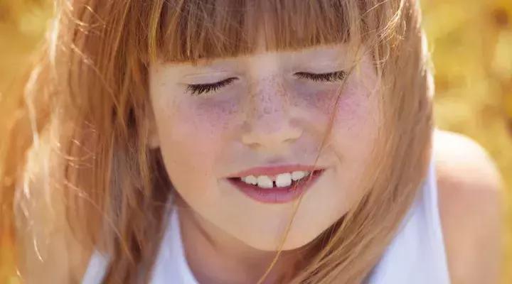 皮肤科医生教你去脸上长斑,皮肤医生讲斑的分类