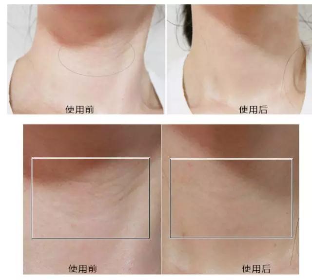 王丽坤范冰冰,王丽坤baby推荐面膜