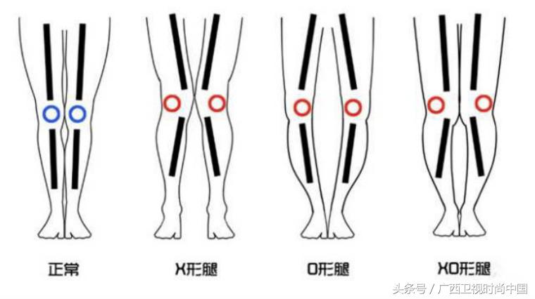 150腿粗小个子适合穿什么靴子,xo型腿适合穿什么样的靴子