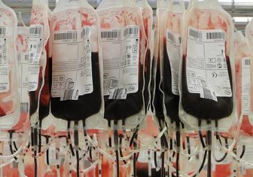 献血发现问题会通知吗,献血就知道病情了吗