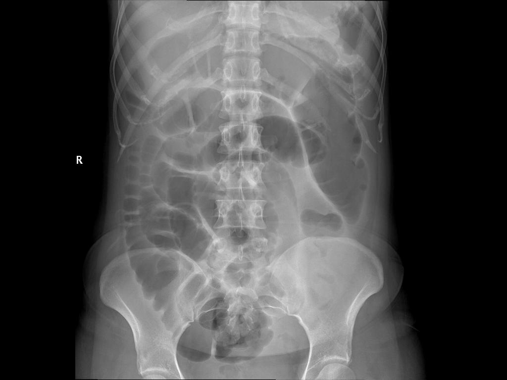 吃橘子不吐皮怎么办,吃橘子不剥皮会怎么样