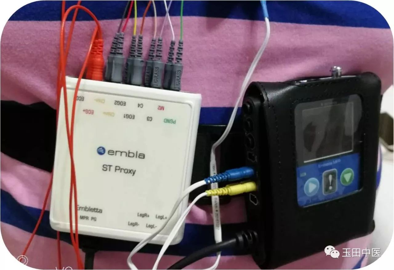 医院用便携式睡眠呼吸监测仪,睡眠监测软件打鼾