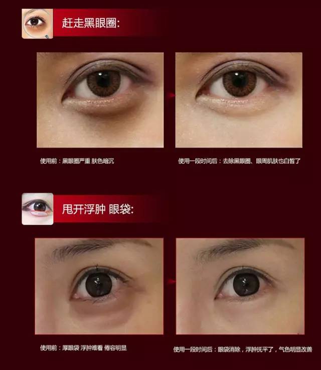 伊思红参蜗牛滚珠眼霜真伪,伊思红参蜗牛滚珠眼霜价格