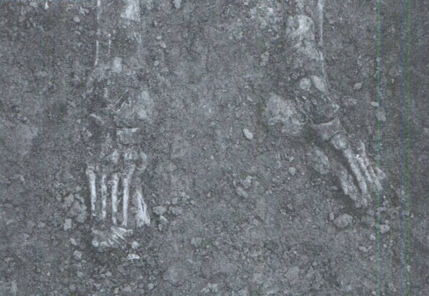 裹小脚的故事,最近的裹小脚事件