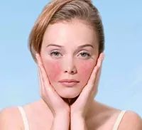 天生高原红的脸用什么修复,高原红的脸用什么修复敏感肌