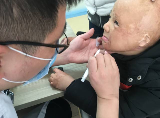 不忘初欣,奕起守护|9958「奕起祛疤童爱救助基金」救助进行中