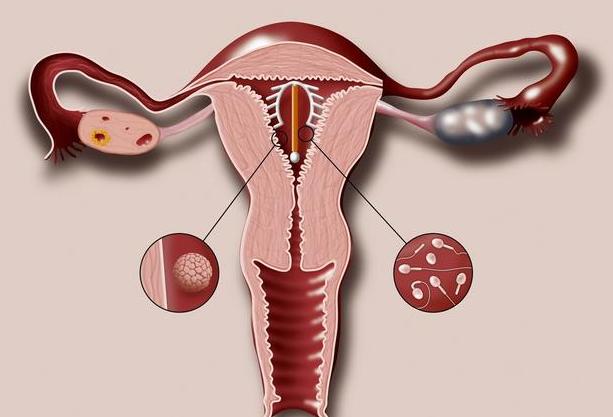 上环后月经一直不干净是怎么回事,上环十余年取环后月经量大正常吗