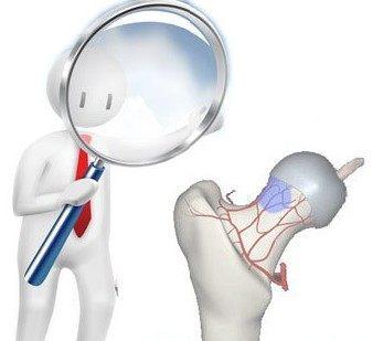 股骨头坏死，用药为何要讲“疗程”？