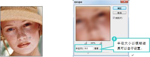 磨皮式祛斑的方法,磨皮祛斑操作流程
