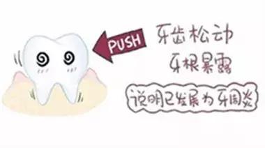 五十牙齿松动什么原因,牙齿松动的4个原因