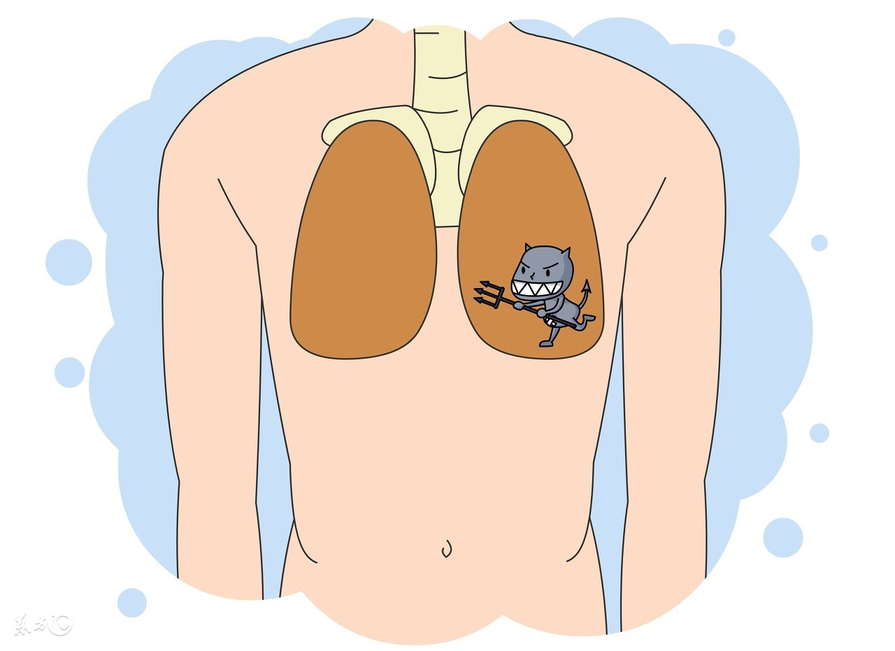 肺癌的十大误区,关于肺癌的八大误区千万别中招了