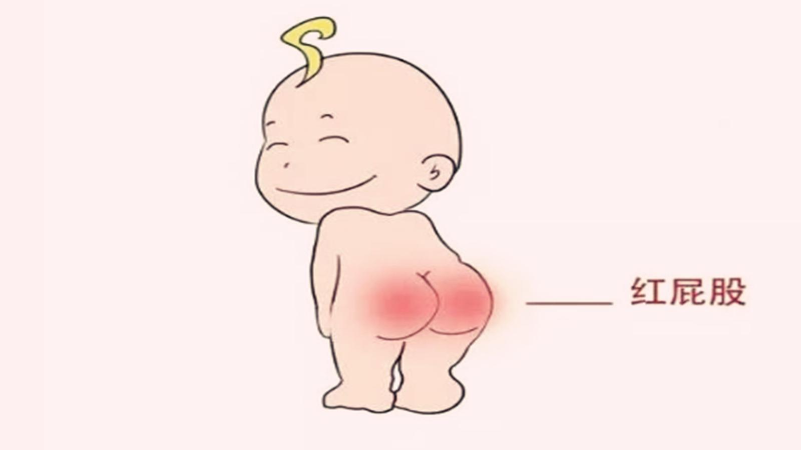 给宝宝擦护臀霜的正确方法,宝宝护臀膏红屁屁如何使用