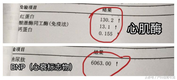 怀孕初期感冒咳嗽喉咙疼怎么办,怀孕感冒咳嗽对胎儿有什么影响