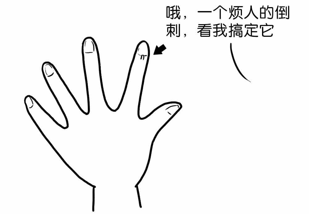 倒刺如何去除扎进手里,倒刺去除