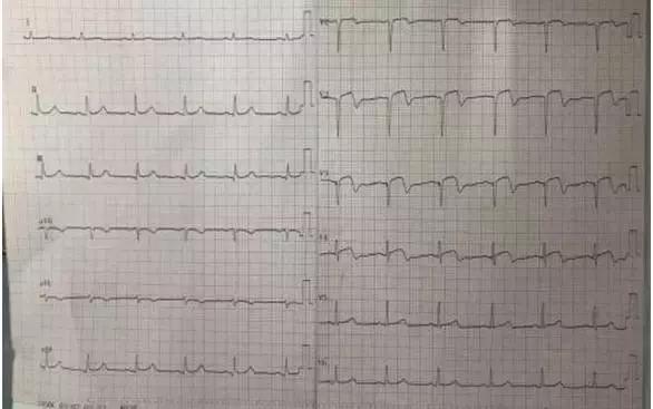 一天抢救两次,一天抢救两次还有救吗