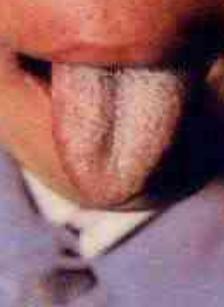 蒲辅周讲舌诊,蒲辅周怎么看舌诊