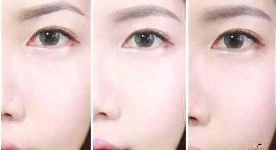 现在才知道原来健康最重要,怎样判断眉间距