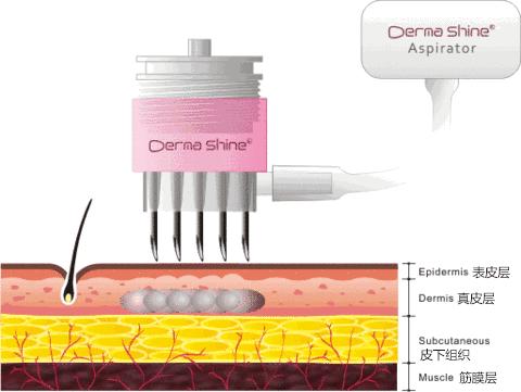 明星水光针美白针,哪些水光针明星在用